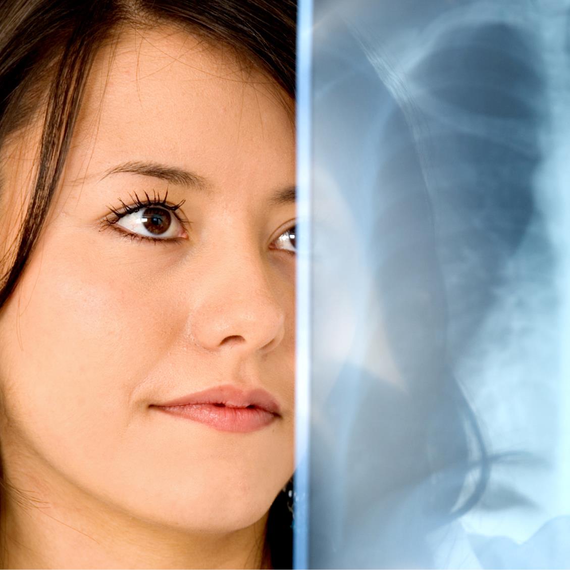 A Tuberculosis Update Activated Insights Store